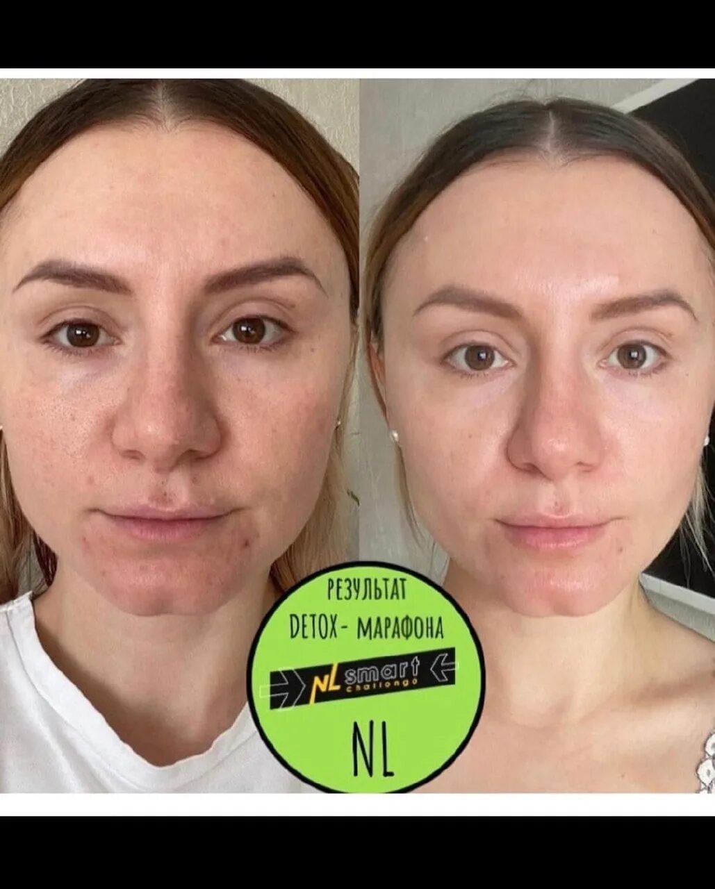 Результаты после детокса. Детокс результаты. Детокс результаты. Детокс nl отзывы до и после. Детокс результаты.