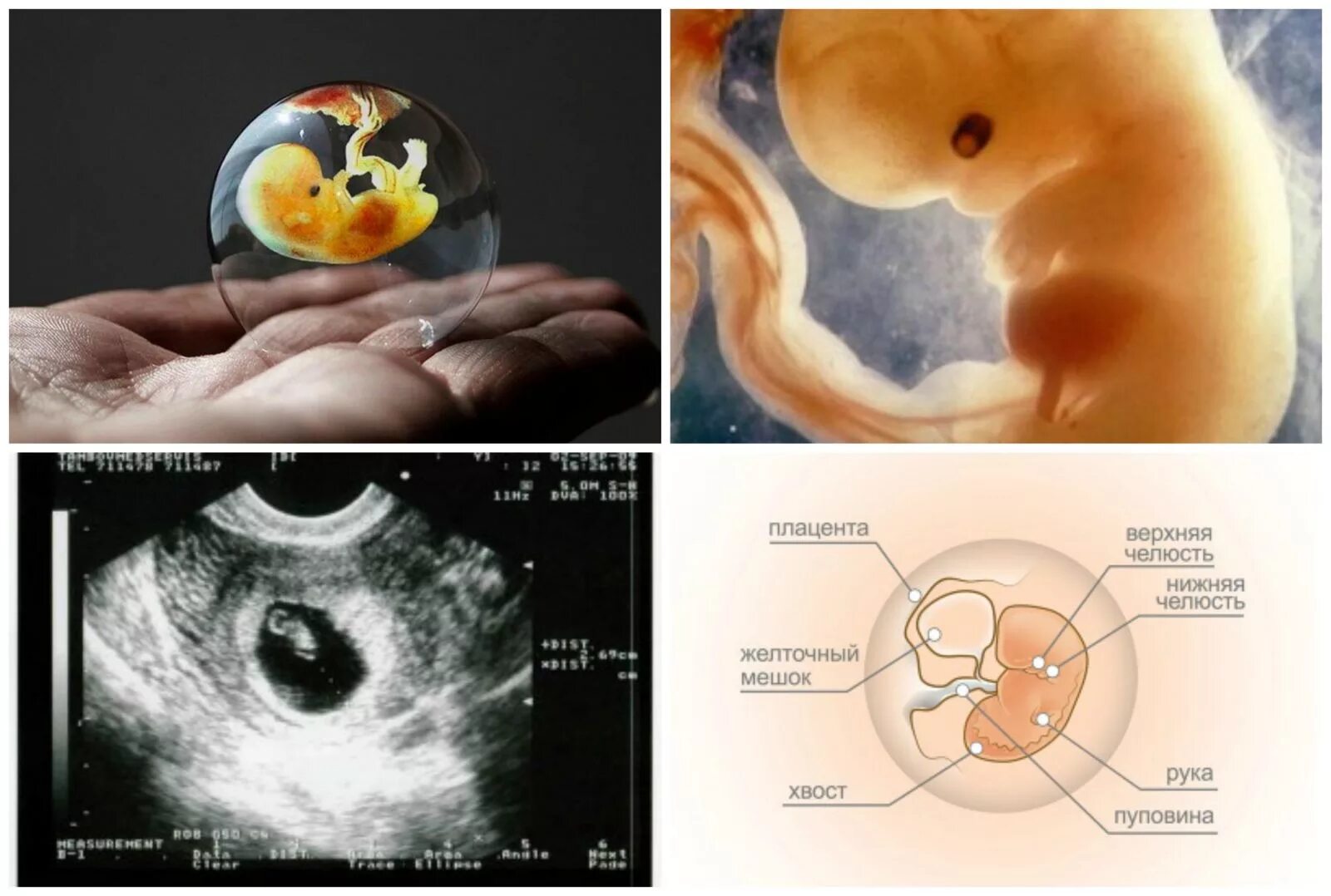 Размер плода на 6 неделе. Эмбрион на 6 неделе беременности УЗИ. 5 6 Недель беременности фото эмбриона на УЗИ. Как выглядит плод на 5-6 недели на УЗИ. 5-6 Недель беременности фото плода на УЗИ.