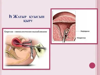 Салбыраған сиськи және волосатые письки порно онлайн