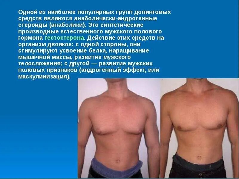 Вылечить андрогенную