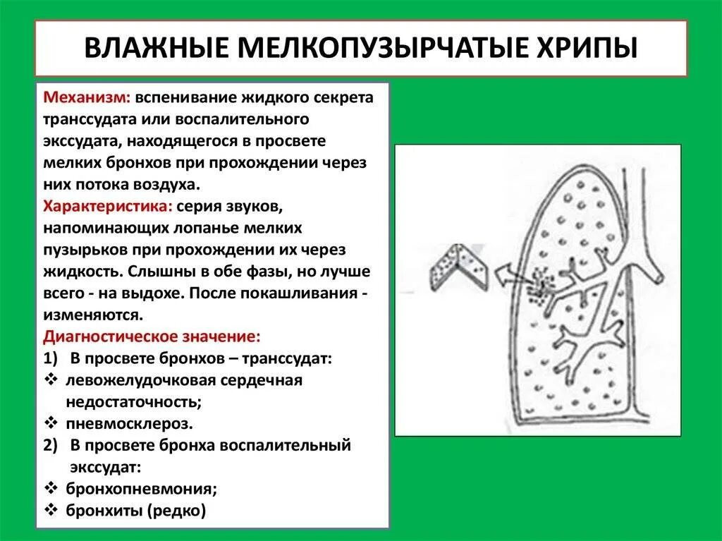 Звуки бронхита. Механизм образования мелкопузырчатых хрипов. Механизм образования мелкопузырчатых хрипов влажных. Влажные мелко пузырчатый хлеб. Влажные хрипы в легких.