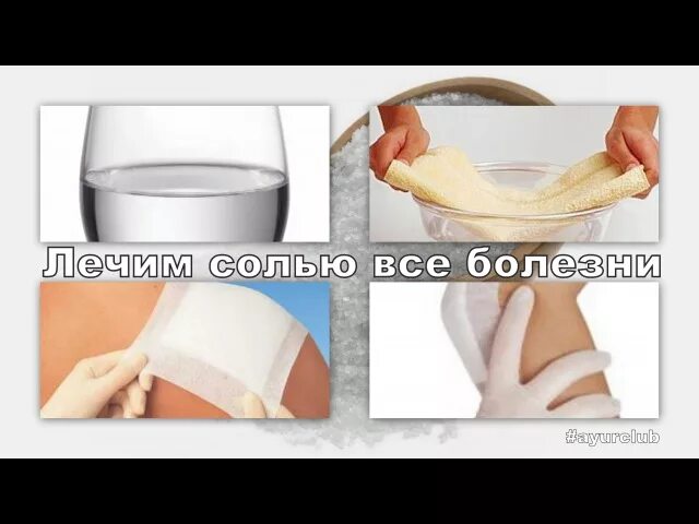 Лечение солевыми повязками