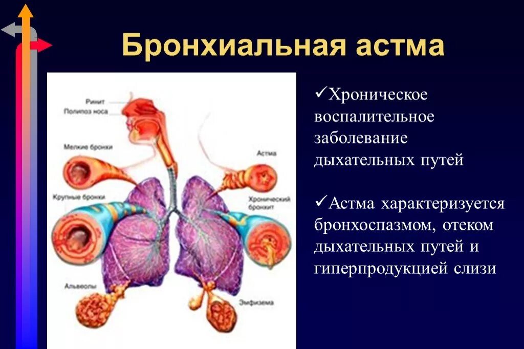 Астма заболевание дыхательных. Дыхательная недостаточность при астме. Припухлость в дыхательных путях. При бронхиальной астме нижние дыхательные пути.