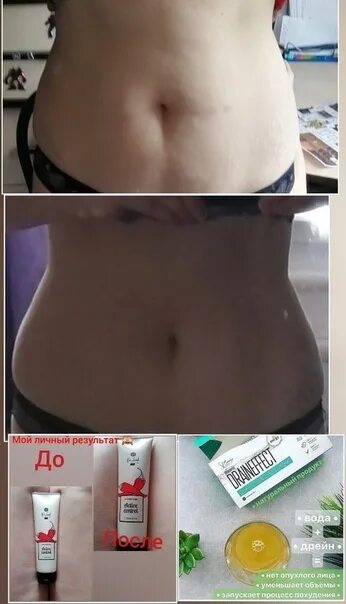 Почему отек живот у женщин. Как выглядят отеки на животе. кск выглядит отекший живот.