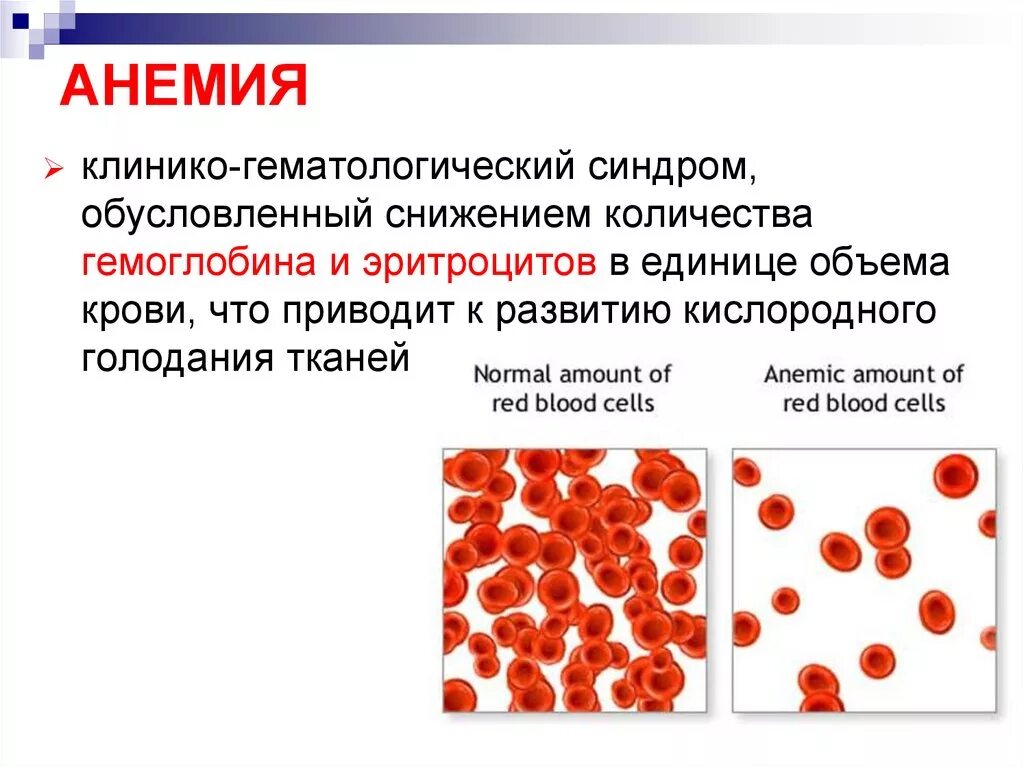 При анемиях используются