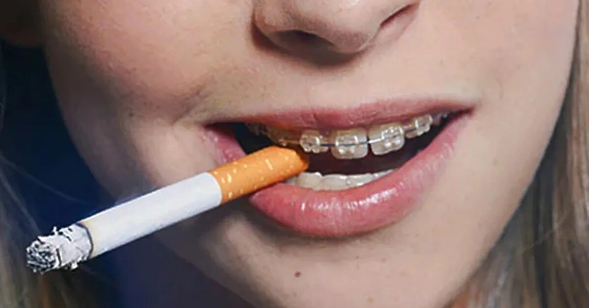 Сигара в зубах. Губы после сигарет