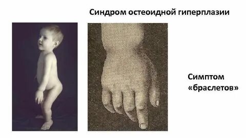 Четкие признаки