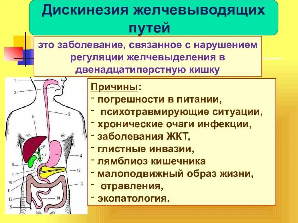 Заболеваний желчевыводящих. Нарушение функций желчевыводящих путей. Дискинезия желчевыводящих путей. Дискинезия желчевыводящих путей симптомы. Симптомы дискинезии желчевыводящих путей.