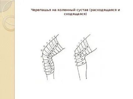 Черепашья повязка на коленный
