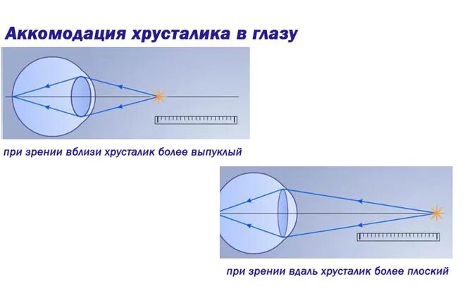 Аккомодация вблизи. Аккомодация хрусталика. схема преломления лучей хрусталиком глаза. аккомодация хрусталикмэто. кривизна хрусталика при аккомодации.