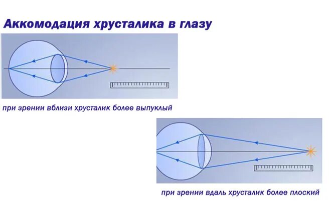 Схема аккомодации хрусталика. Аппарат аккомодации глаза схема. Схема преломления лучей хрусталиком глаза. Аккомодация хрусталикмэто. Расстояние аккомодации