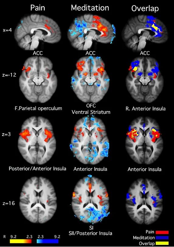 Медитация для мозга. Активность мозга при медитации. Мозг при медитации. Мрт мозга при медитации. Мозг до и после медитации.