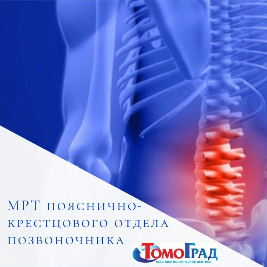 сколиоз жалобы у детей. исследование позвоночника. остеопатия позвоночник. межпозвоночная грыжа поясничного отдела симптомы. методы диагностики позвоночника.