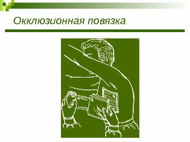 Техника наложения окклюзионной