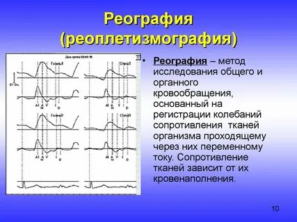 Реограмма