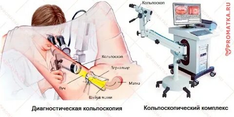 Осмотр гинеколога шейка матки