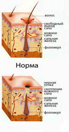 Что если из