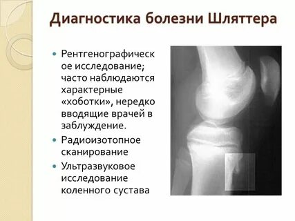 Болезнь шляттера мкб 10 код у детей