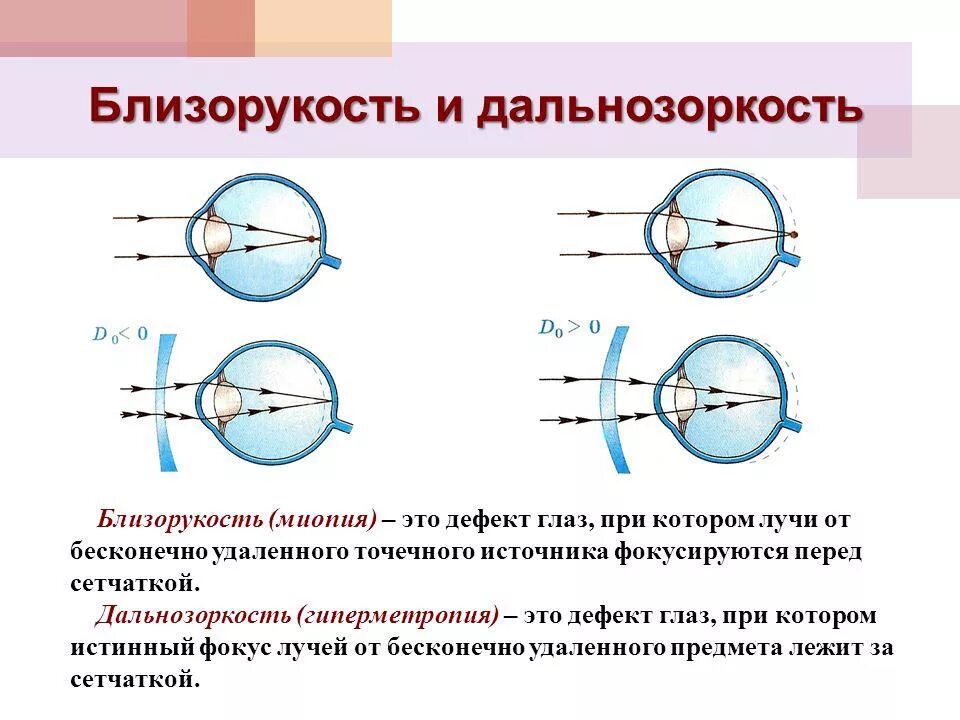 Коррекция зрения с помощью линз. Зрение близорукость и дальнозоркость. Линзы для близорукости и дальнозоркости физика. Изменения в глазу при дальнозоркости и близорукости. Близорукость и дальнозоркость схема физика.