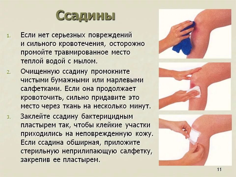 Сгоряча он не обратил внимания на ушиб. Первая помощь при садиноа. первая помощь при ушибах и ссадинах. оказание первой медицинской помощи при ушибах ссадинах.