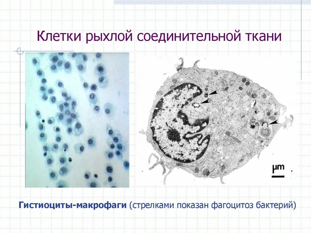 Гистиоциты соединительной ткани. Макрофаги клетки гистиоциты. Клетки фагоциты рыхлосоединительной ткани. Гистиоциты в рыхлой соединительной ткани. Свободные макрофаги