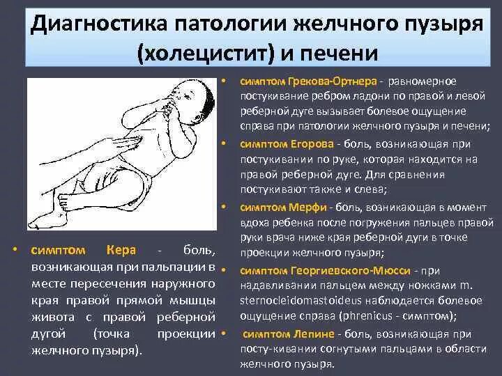 Точки болезненности. Симптомы Кера Мерфи Ортнера. Симптом Ортнера Кера Мюсси Мерфи. Холецистит симптом Кера. Симптомы сдавления желчного пузыря Кера Мерфи.