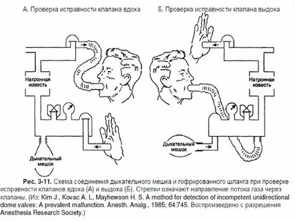 Клапан вдоха