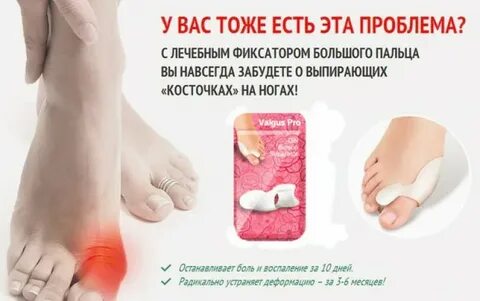 Средства косточки большом пальце