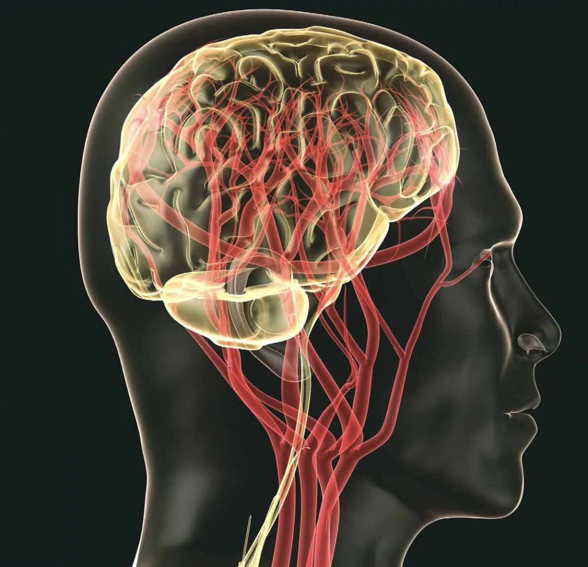 атеросклероз сосудов брахиоцефальных артерий. атеросклероз сосудов брахиоцефальных артерий. анатомия брахиоцефального ствола. сонная артерия брахиоцефальный ствол. каротидная система кровоснабжения.