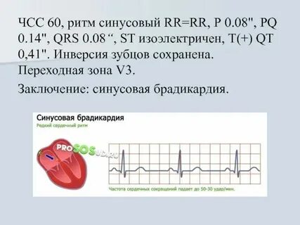 Синусовый ритм вертикальное положение электрической оси сердца