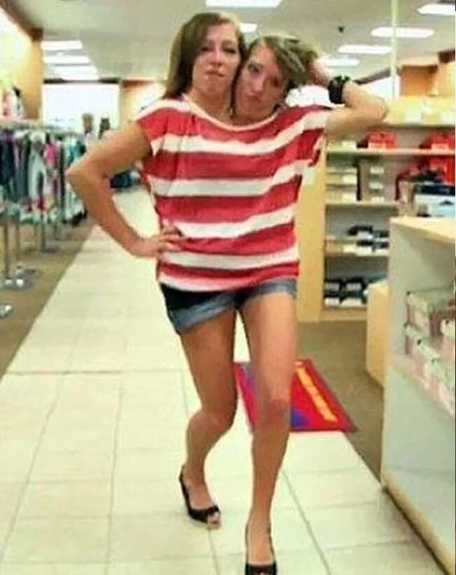 Сиамские сестры эбигейл и бриттани хенсел. Девочка с двумя головами. Сёстры эбигейл и бриттани. Девочка с двумя головами. Девочка с двумя головами.