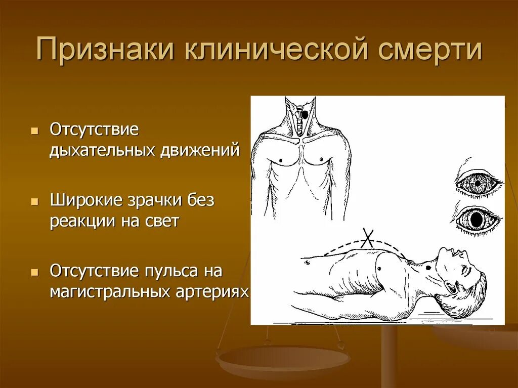 Признаки клинической смерти. Признаки клинической. Марти. Признаки клинической и биологической смерти. Признаки клиническо йсмети.