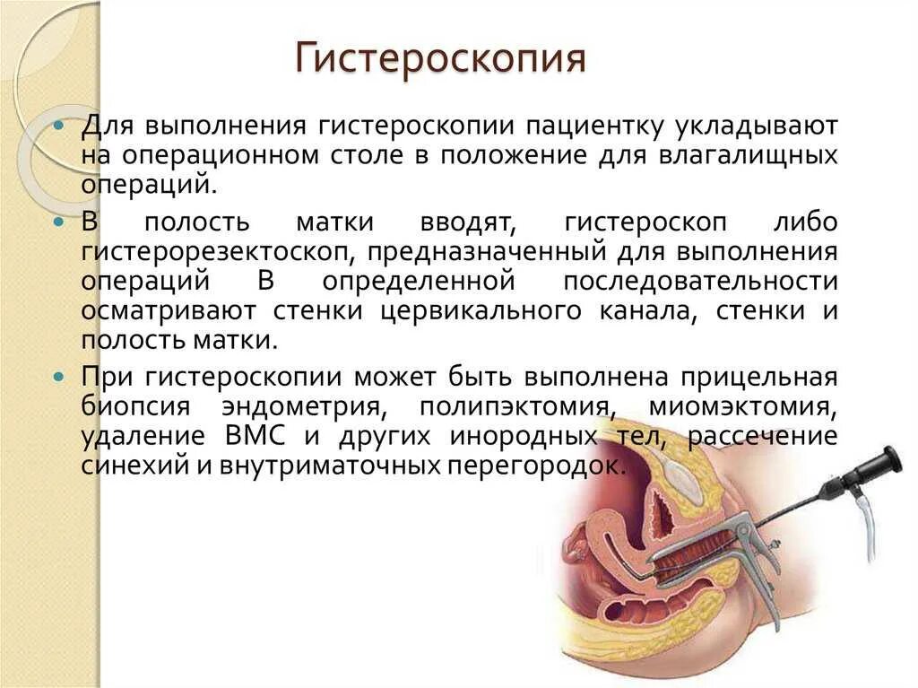 Сколько кровит после выскабливания. Гистероскопия этапы проведения для операции. Гистероскопия и выскабливание матки. Операция гистероскопия выскабливание полости матки. Гистерорезектоскопия полипа эндометрия.