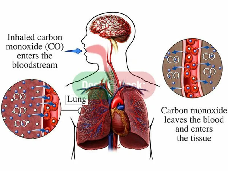 бронхиальная астма мокрота. попадание воды в дыхательные пути. попадание жидкости в легкие. еда не попадает в легкие. что будет если в легкие попадет.