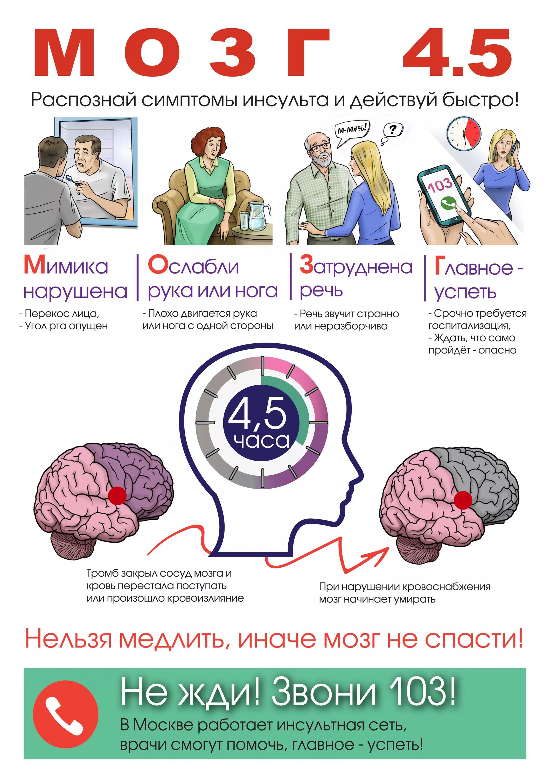 Инсульт диагностика лечение. Инсульт. диагностика инсульта. 4 инсульта. профилактика инсульта.