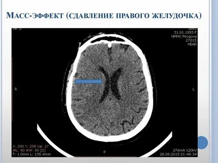 Кт вес