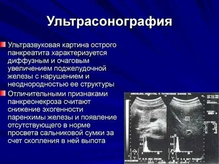 Структура поджелудочной диффузно неоднородная эхогенность повышена