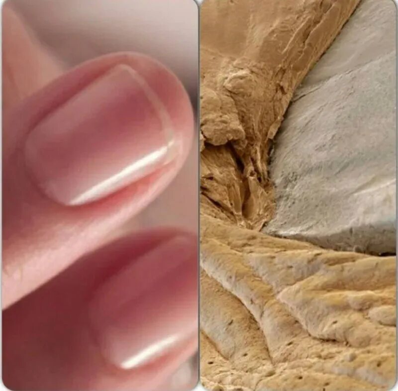 Поврежденные волосы. Как выглядит ноготь под микроскопом. Как выглядит ноготь под микроскопом. Ноготь под микроскопом человека. Как выглядит ноготь под микроскопом.