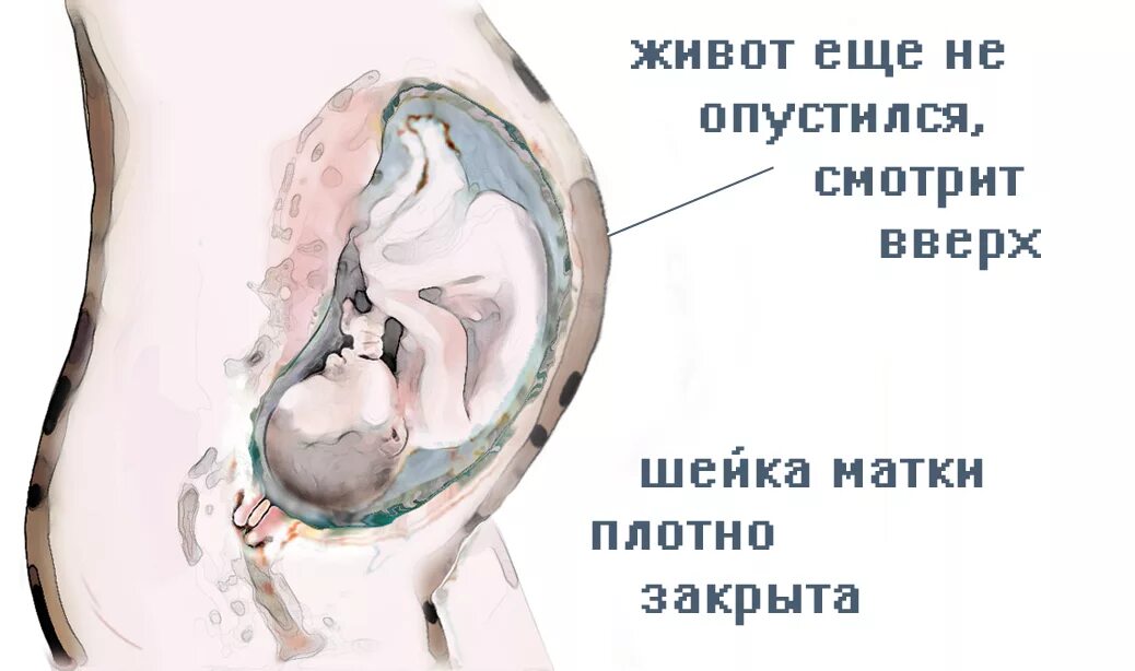 Роды 40 недель шейка не готова. Раскрытие при беременности. Раскрытие шейки при родах.