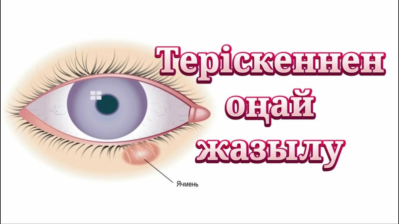 Ячмень блефарит халязион. Терискен. Халязион халязион халязион. Мейбомит ячмень халязион. Абмурдирующий халязион.