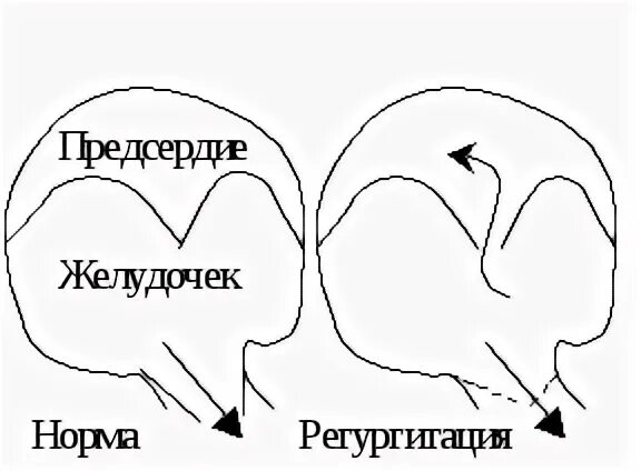 Недостаточность нескольких органов r 68.8