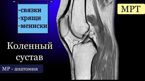 Мрт суставов в одинцово