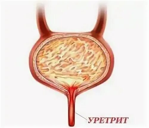Жжение в головке после мочеиспускания