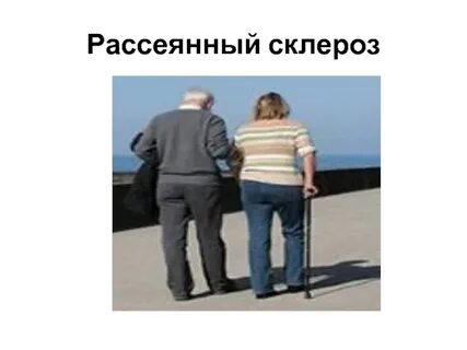 Сколько живут с рассеянным