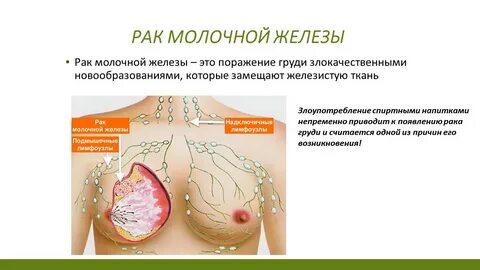 Чем опасен рак молочной железы