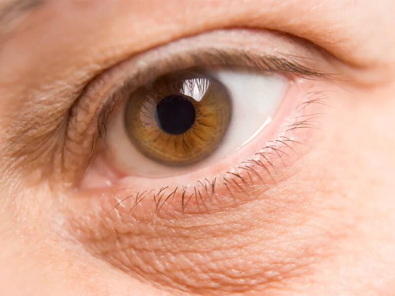 Желтые круги под глазами у мужчин причина. Коричневые полосы под глазами. Кожа вокруг глаз коричневого цвета.