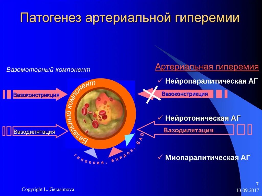 Патогенез артериальной гиперемии схема. Гиперемия этиология. Патогенез венозной гиперемии патофизиология. Патогенез артериальной гиперемии. Механизм венозной гиперемии патофизиология.