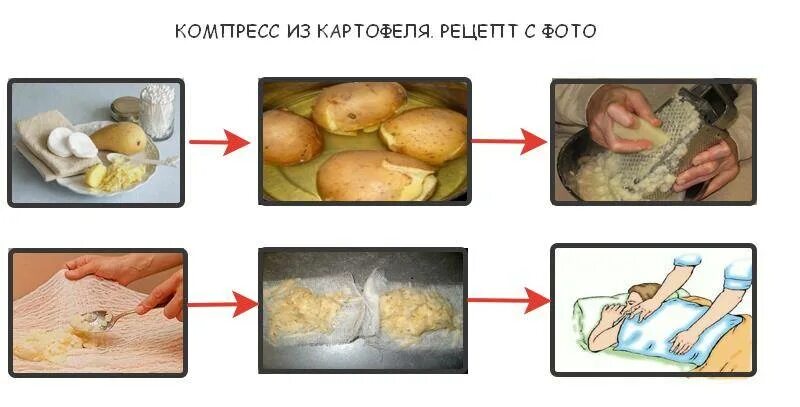 Компресс от кашля с картошкой. Компресс с картофелем от ожога.