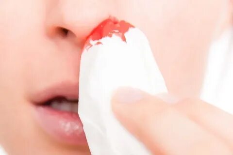 Чихаю кровью причины