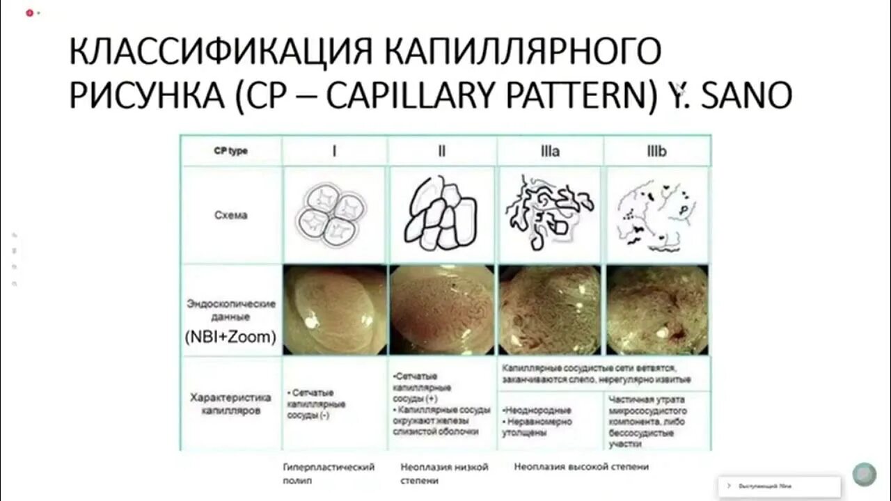 Типы полипов классификация. Классификация полипов эндоскопия. классификация полипов кишечника. классификация полипов толстой кишки. классификация полипов по кудо.